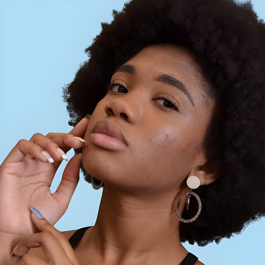 Parches Clearish para el Acné: Una Nueva Era en el Tratamiento del Acné